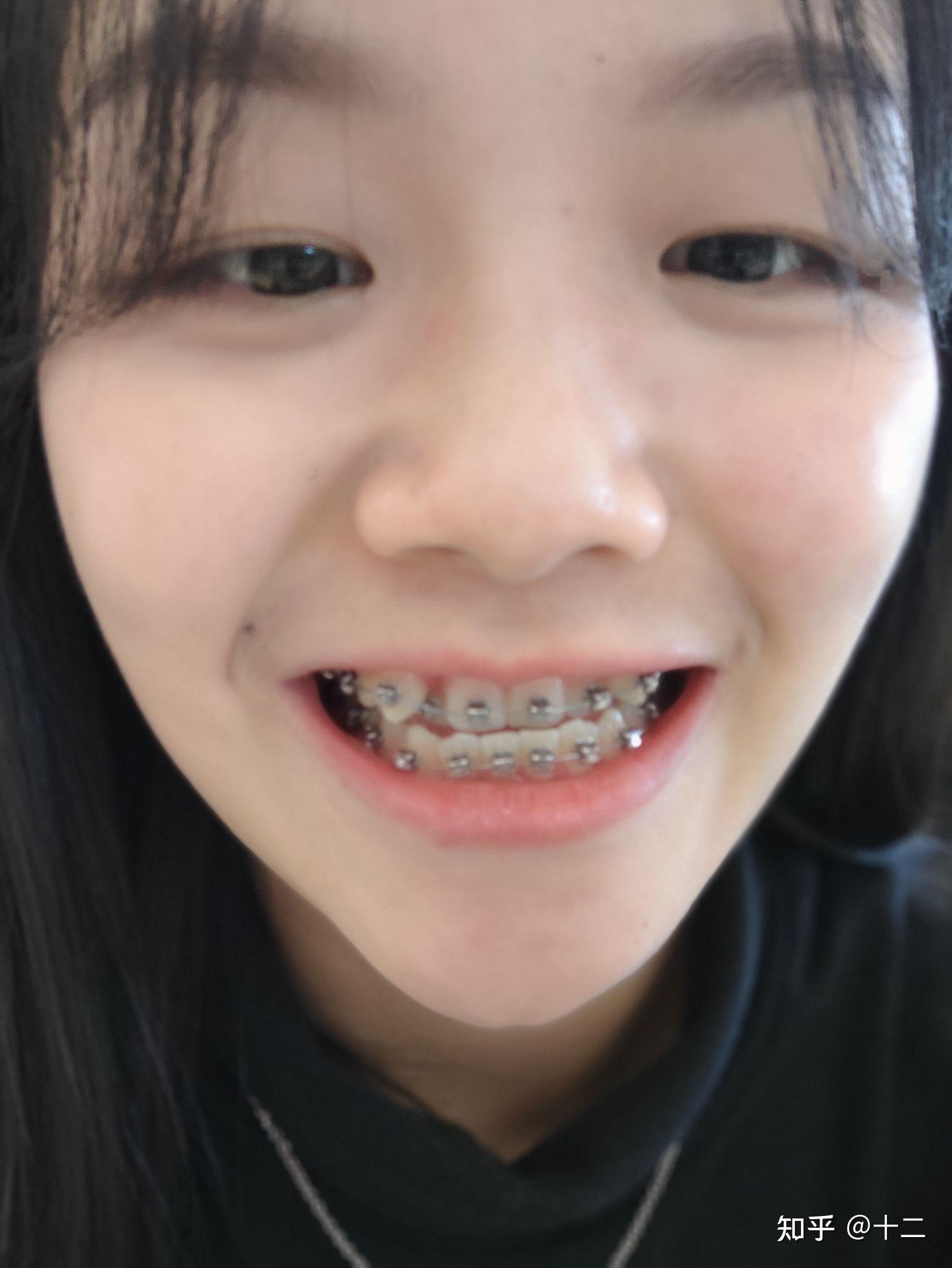 下载苹果版虎牙苹果手机怎么在虎牙直播